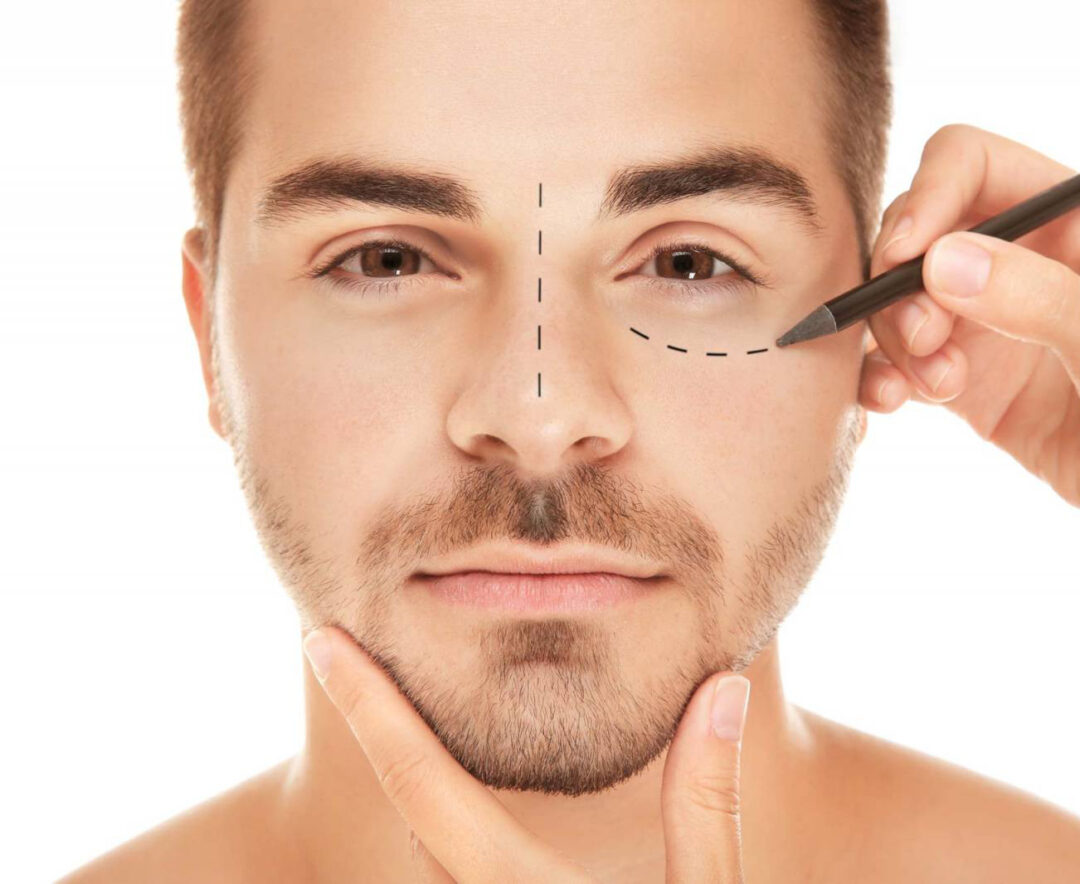 Chirurgie des paupières à Provence